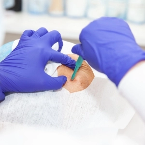Biopsia renal renix Clínica de Hemodiálisis y Nefrología en Iztapalapa